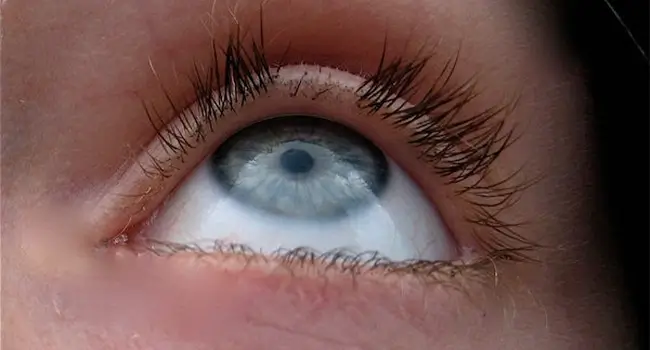 Why Eyelashes Fall Out